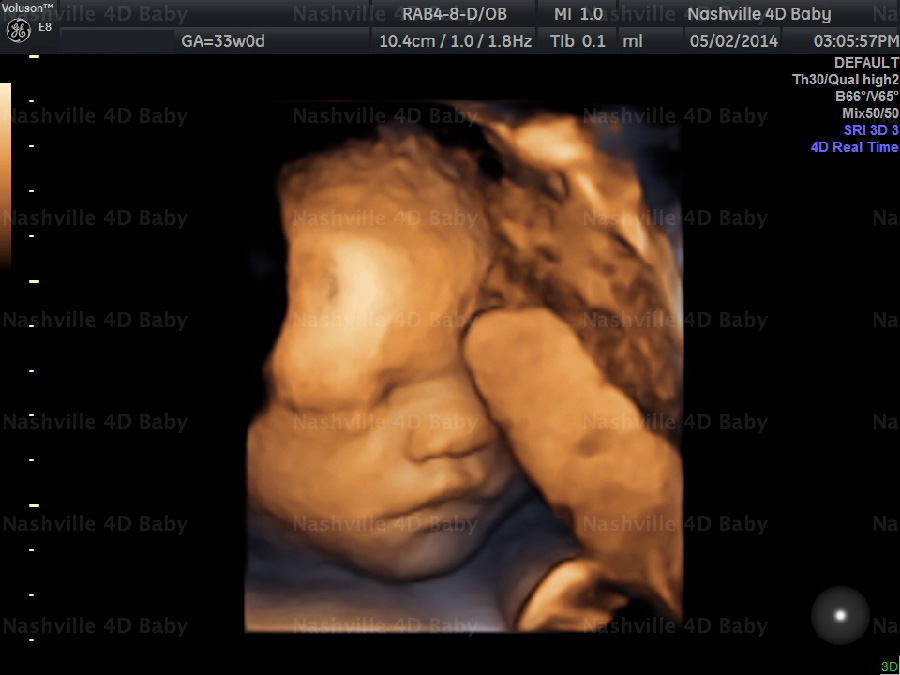 Photo Gallery, 3D/4D HD Live Elective Ultrasound